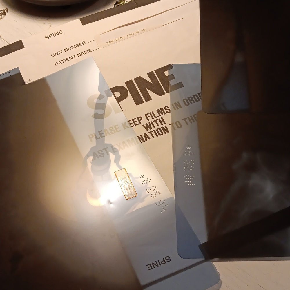 SPINE XRAYS